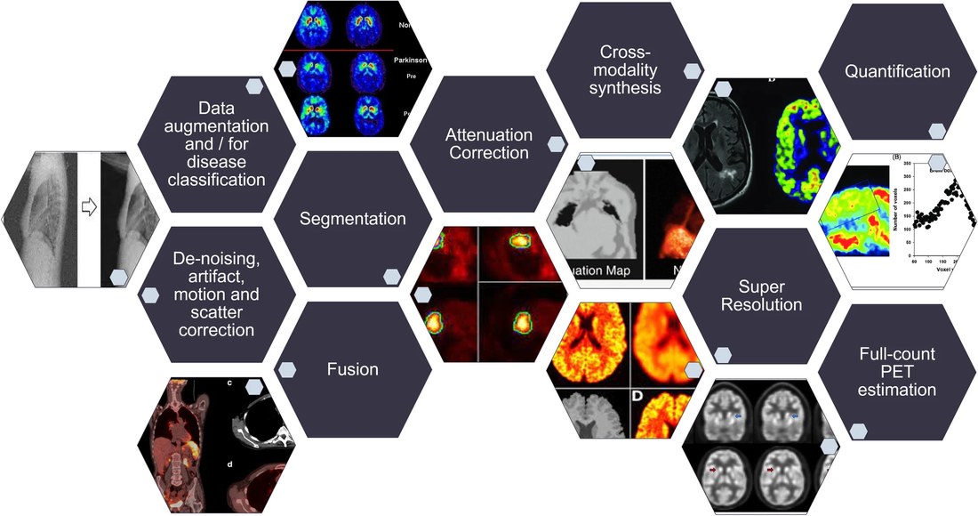 GAN-generated PET imaging figure